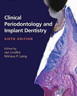 Clinical Periodontology and Implant Dentistry, 2 Volume Set (6th edition) – eBook PDF