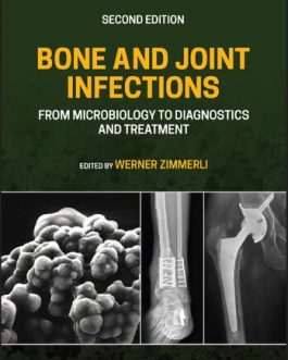 Bone and Joint Infections: From Microbiology to Diagnostics and Treatment (2nd Edition) – PDF eBook