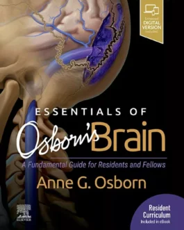 Essentials of Osborn’s Brain – PDF
