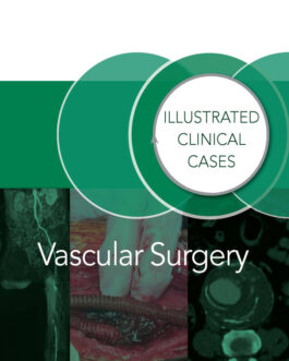 Vascular Surgery: Illustrated Clinical Cases – PDF
