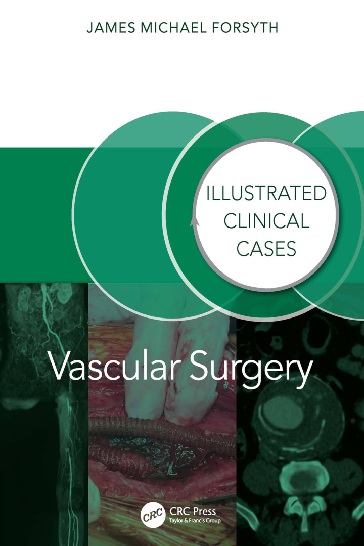 Vascular Surgery: Illustrated Clinical Cases – PDF