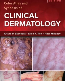 Fitzpatrick’s Color Atlas and Synopsis of Clinical Dermatology (9th Edition) – eBook PDF