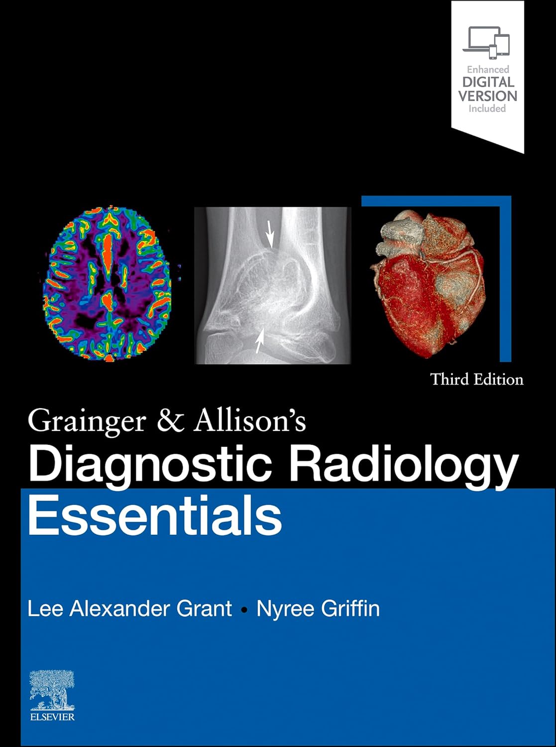 Grainger & Allison's Diagnostic Radiology Essentials (3rd Edition) – eBook PDF