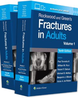 Rockwood and Green’s Fractures in Adults (10th Edition) eBook without Multimedia – eBook PDF